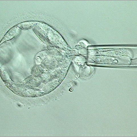 biopsy of embryo