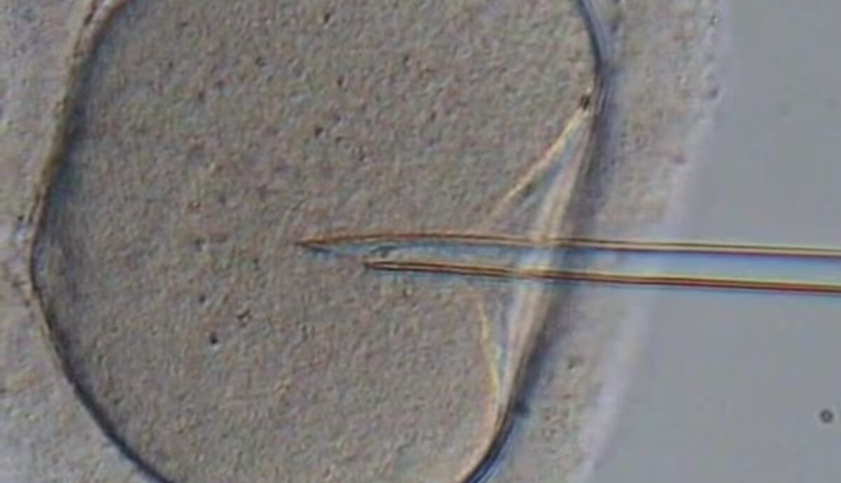 ICSI or Intra-Cytoplasmic Sperm Injection